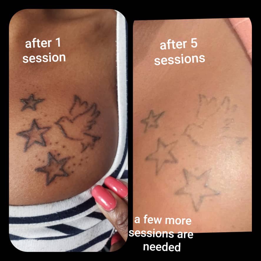 picture of tattoo